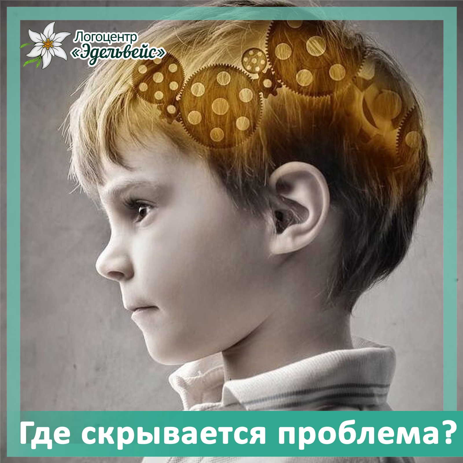 Центральная нервная система